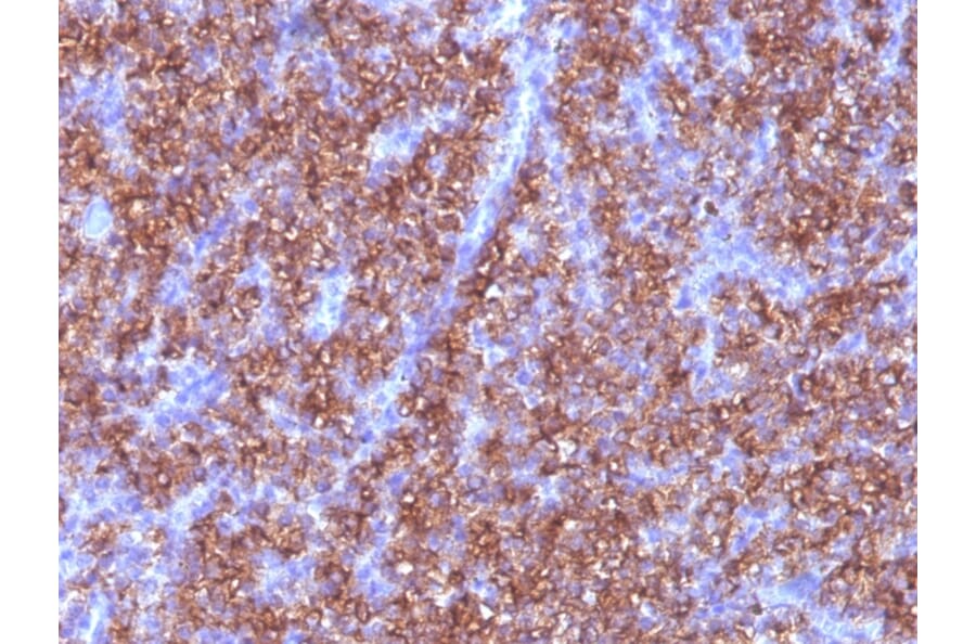 Immunohistochemistry - Anti-Chromogranin A Antibody [CGA/413] (A248205) - Antibodies.com