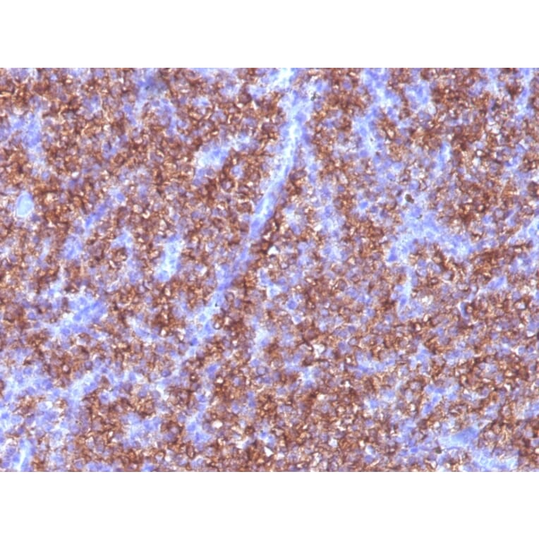 Immunohistochemistry - Anti-Chromogranin A Antibody [CGA/413] (A248205) - Antibodies.com