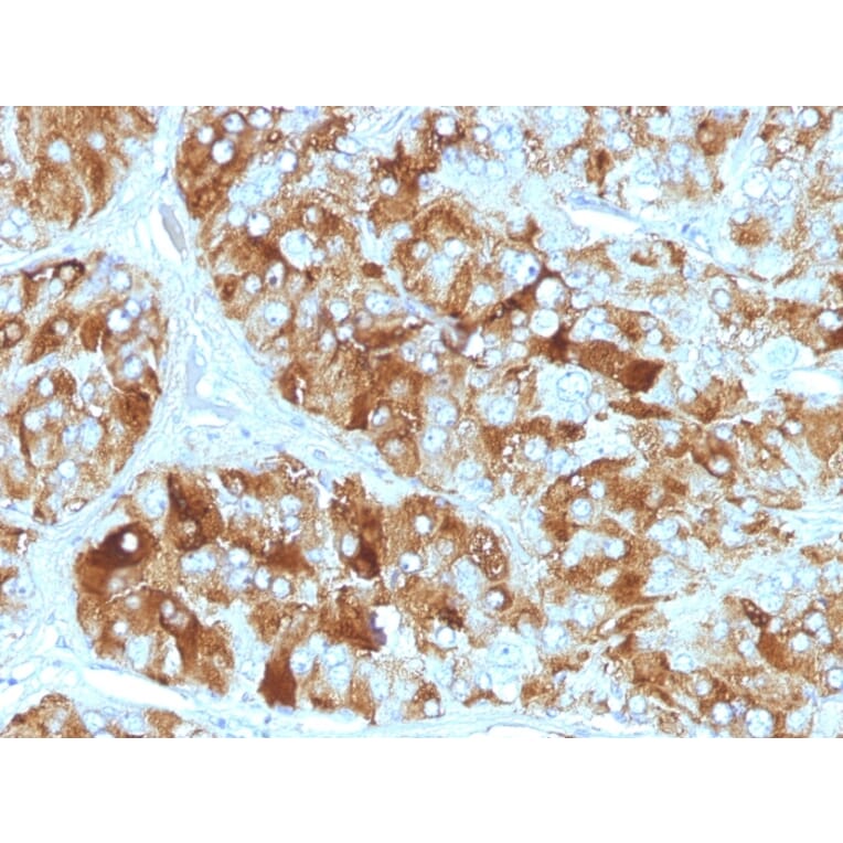 Immunohistochemistry - Anti-Chromogranin A Antibody [CGA/413] (A248205) - Antibodies.com