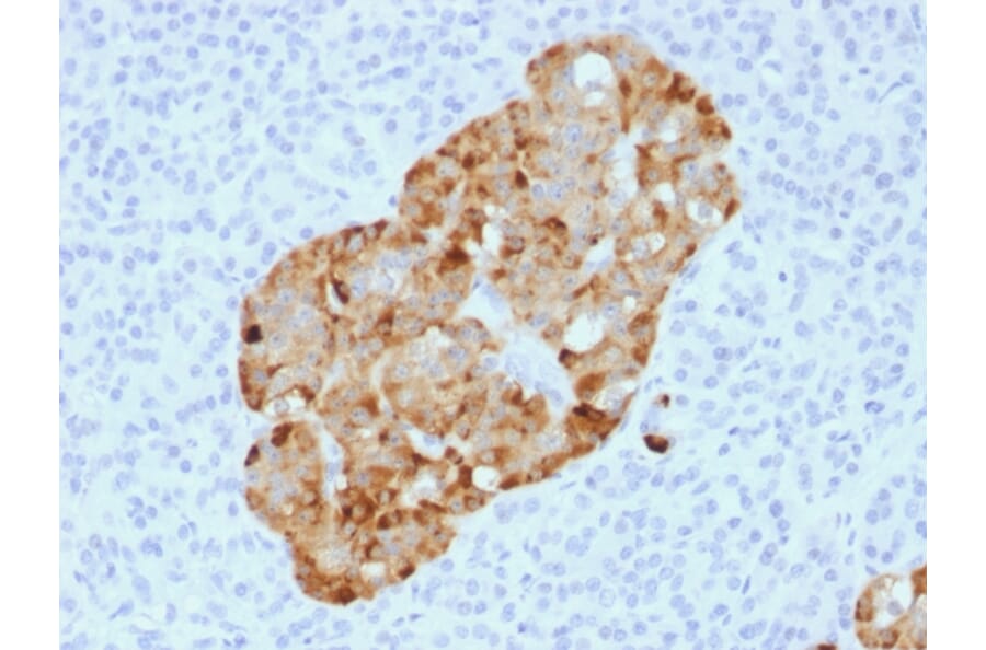 Immunohistochemistry - Anti-Chromogranin A Antibody [CHGA/1731R] (A248206) - Antibodies.com
