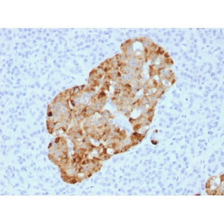 Immunohistochemistry - Anti-Chromogranin A Antibody [CHGA/1731R] (A248206) - Antibodies.com