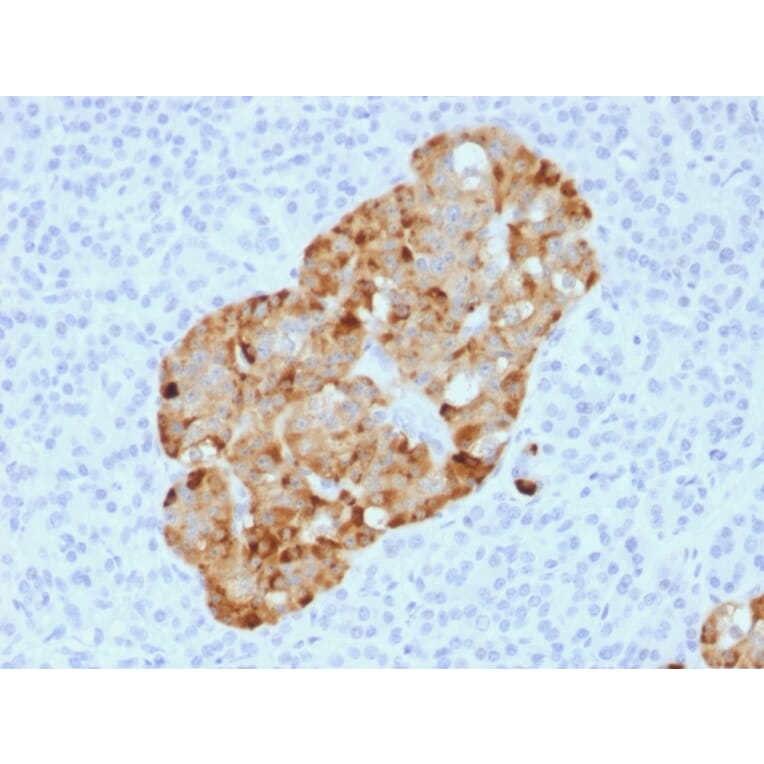 Immunohistochemistry - Anti-Chromogranin A Antibody [CHGA/1731R] (A248206) - Antibodies.com