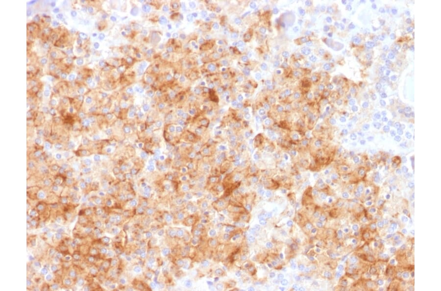 Immunohistochemistry - Anti-Chromogranin A Antibody [CHGA/1731R] (A248206) - Antibodies.com