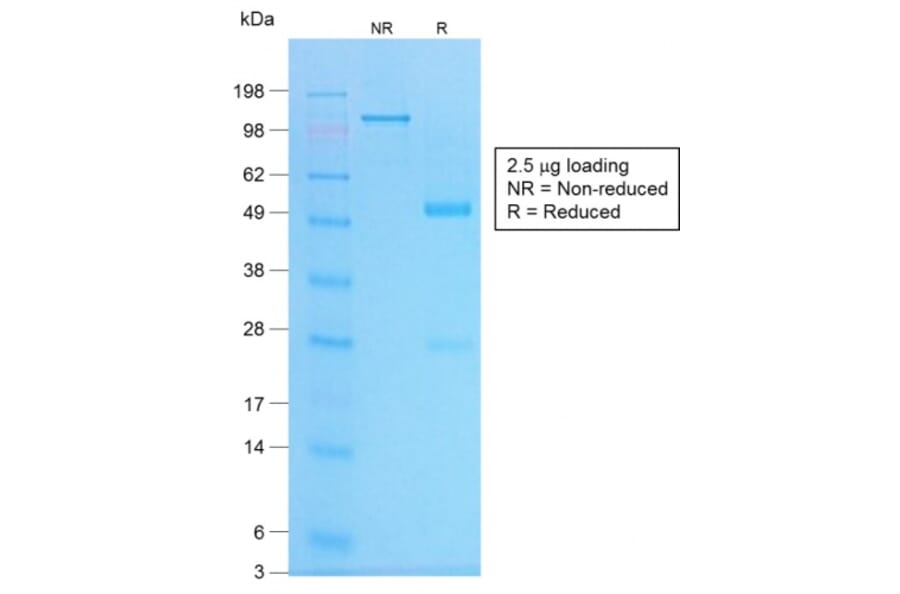 SDS-PAGE - Anti-Chromogranin A Antibody [CHGA/1773R] (A248207) - Antibodies.com