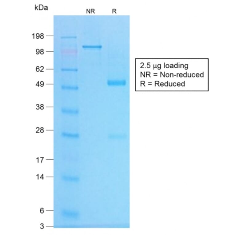 SDS-PAGE - Anti-Chromogranin A Antibody [CHGA/1773R] (A248207) - Antibodies.com