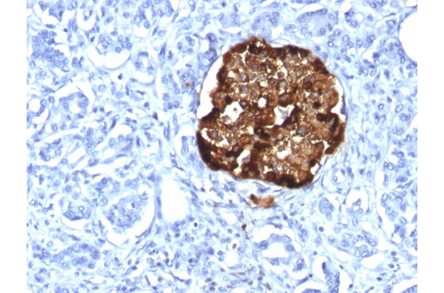 Immunohistochemistry - Anti-Chromogranin A Antibody [CHGA/1815R] (A248208) - Antibodies.com