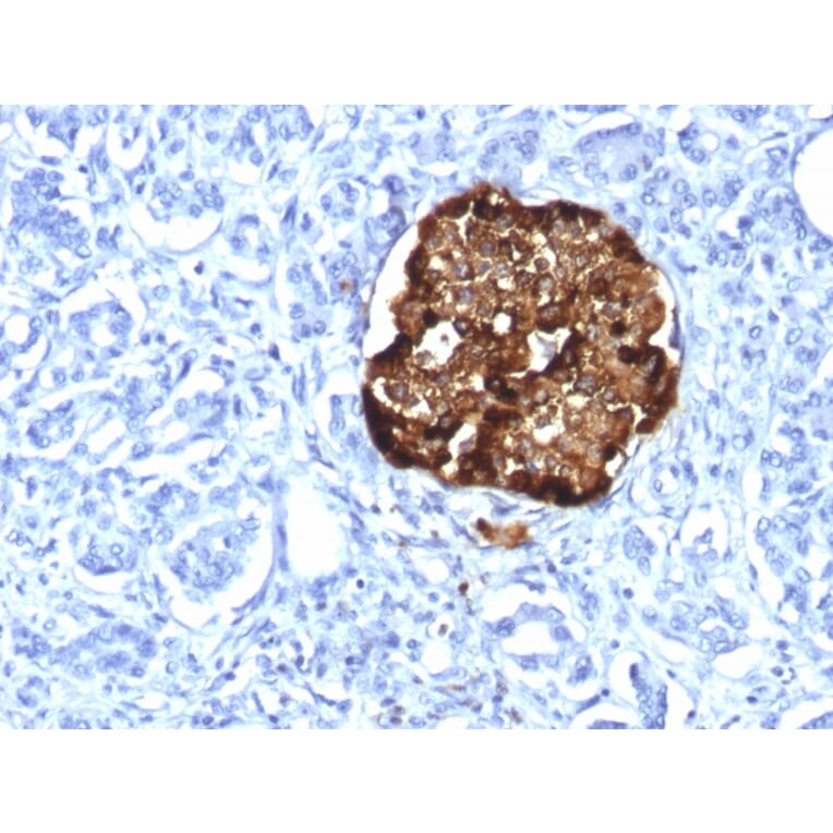 Immunohistochemistry - Anti-Chromogranin A Antibody [CHGA/1815R] (A248208) - Antibodies.com