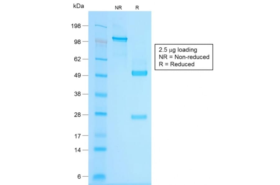SDS-PAGE - Anti-Chromogranin A Antibody [CHGA/1815R] (A248208) - Antibodies.com