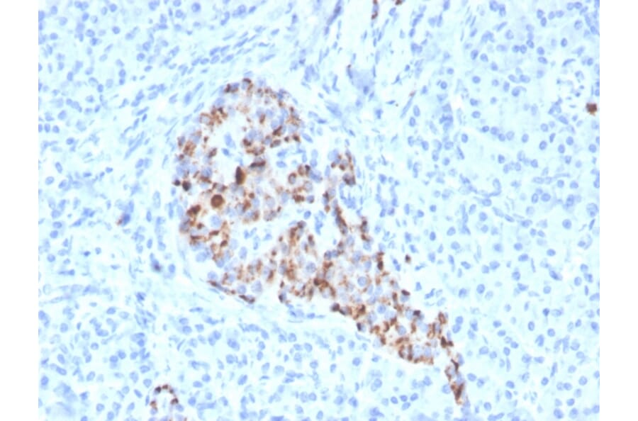 Immunohistochemistry - Anti-Chromogranin A Antibody [CHGA/4544R] (A248209) - Antibodies.com