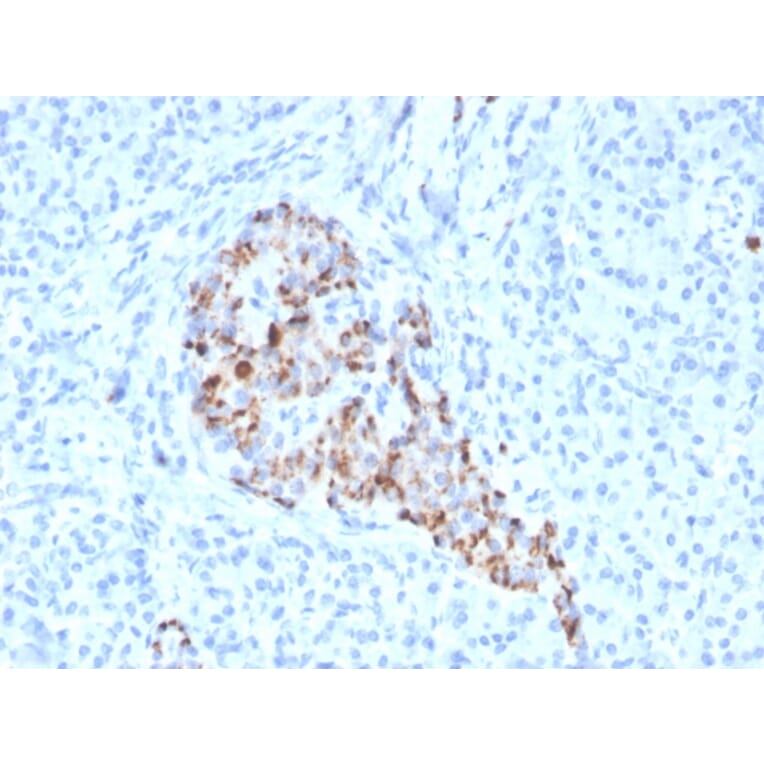Immunohistochemistry - Anti-Chromogranin A Antibody [CHGA/4544R] (A248209) - Antibodies.com