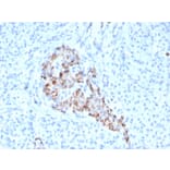 Immunohistochemistry - Anti-Chromogranin A Antibody [CHGA/4544R] (A248209) - Antibodies.com
