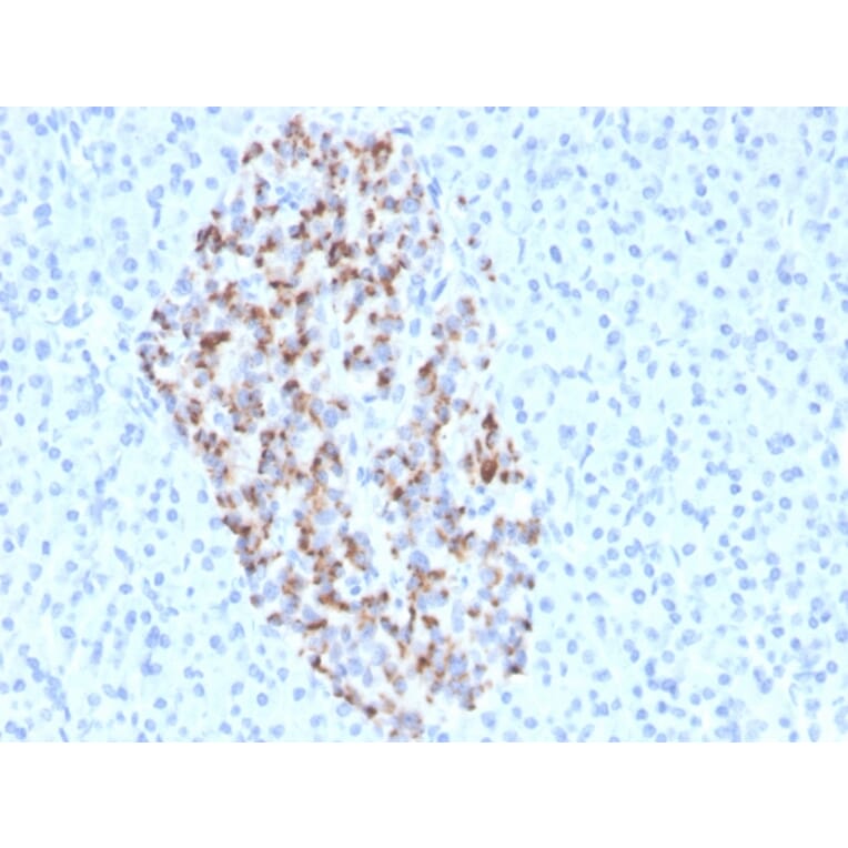 Immunohistochemistry - Anti-Chromogranin A Antibody [CHGA/4544R] (A248208) - Antibodies.com