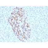 Immunohistochemistry - Anti-Chromogranin A Antibody [CHGA/4544R] (A248208) - Antibodies.com