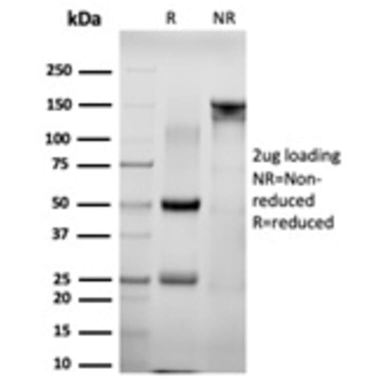 SDS-PAGE - Anti-NACC1 Antibody [PCRP-NACC1-1A8] (A248213) - Antibodies.com