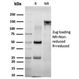 SDS-PAGE - Anti-NACC1 Antibody [PCRP-NACC1-1A8] (A248213) - Antibodies.com