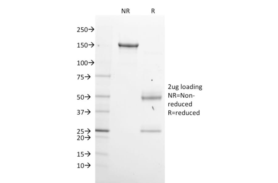 SDS-PAGE - Anti-GPN1 Antibody [GPN1/2350] (A248214) - Antibodies.com