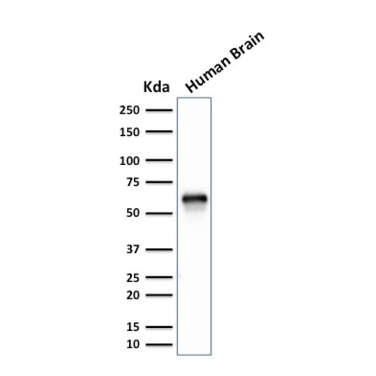 Western Blot - Anti-GPN1 Antibody [GPN1/2350] (A248214) - Antibodies.com