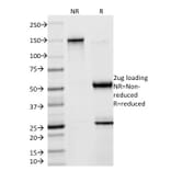 SDS-PAGE - Anti-Creatine Kinase BB Antibody [2ba6] (A248215) - Antibodies.com