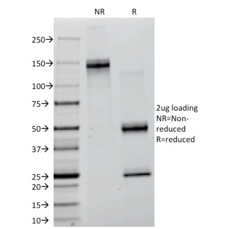SDS-PAGE - Anti-Creatine Kinase BB Antibody [CKB/1268] (A248216) - Antibodies.com