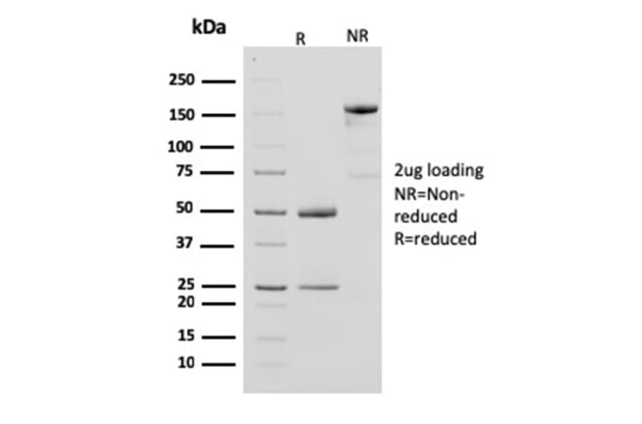 SDS-PAGE - Anti-Creatine Kinase BB Antibody [CPTC-CKB-2] (A248216) - Antibodies.com