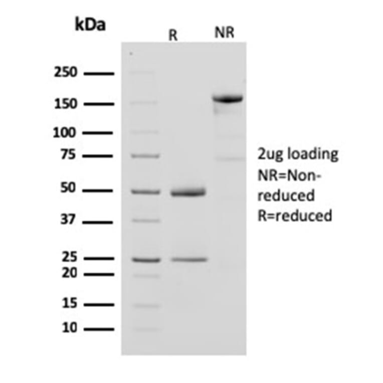 SDS-PAGE - Anti-Creatine Kinase BB Antibody [CPTC-CKB-2] (A248216) - Antibodies.com