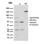 SDS-PAGE - Anti-Creatine Kinase BB Antibody [CPTC-CKB-2] (A248216) - Antibodies.com