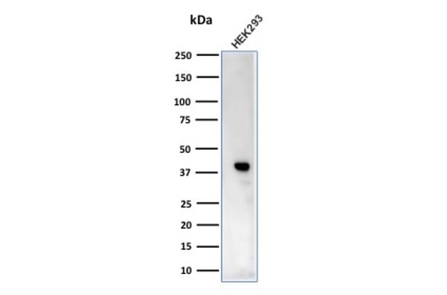 Western Blot - Anti-Creatine Kinase BB Antibody [CPTC-CKB-2] (A248217) - Antibodies.com