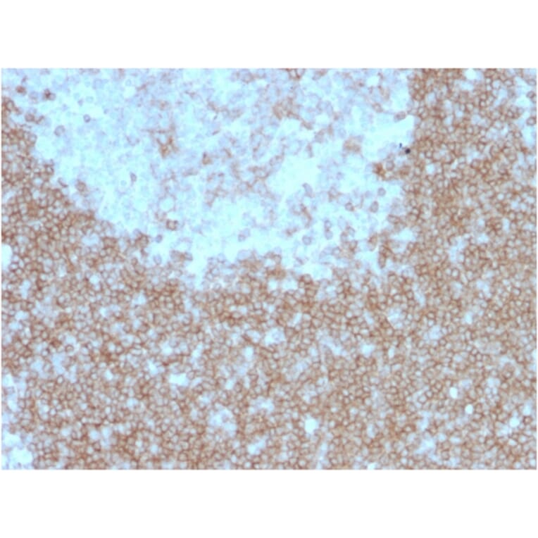 Immunohistochemistry - Anti-BAFF-R Antibody [BAFFR/1557] (A248217) - Antibodies.com