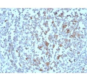 Immunohistochemistry - Anti-BAFF-R Antibody [BAFFR/1558] (A248218) - Antibodies.com