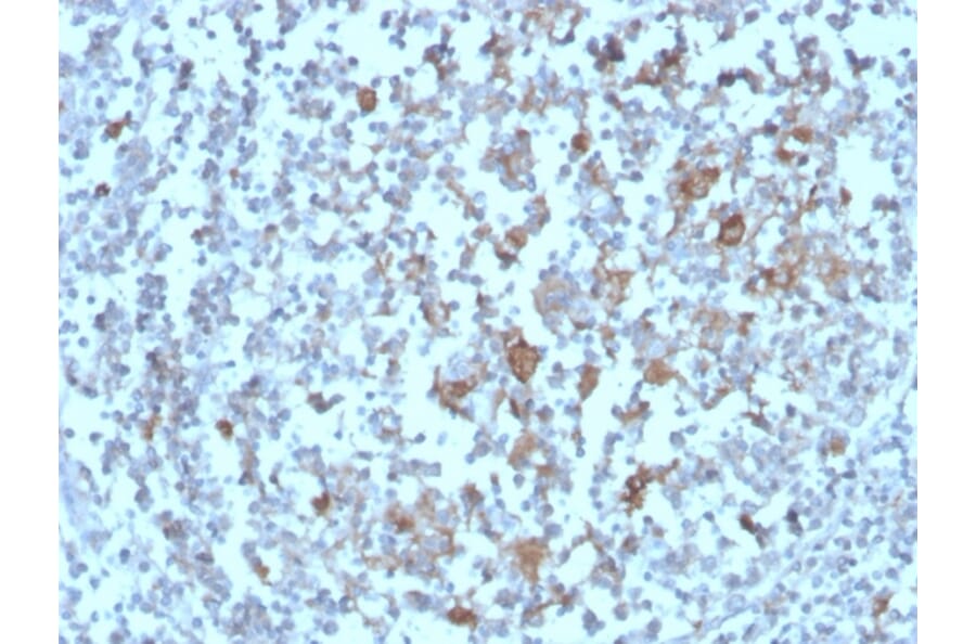 Immunohistochemistry - Anti-BAFF-R Antibody [BAFFR/1558] (A248218) - Antibodies.com