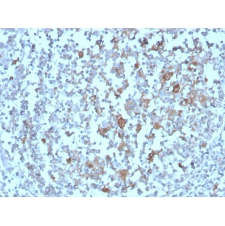 Immunohistochemistry - Anti-BAFF-R Antibody [BAFFR/1558] (A248218) - Antibodies.com
