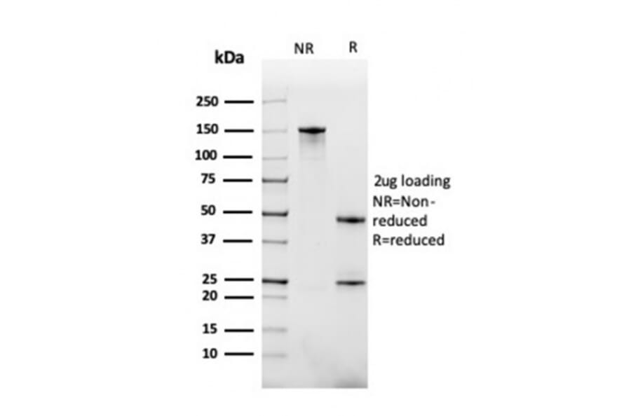 SDS-PAGE - Anti-BAFF-R Antibody [BAFFR/1558] (A248219) - Antibodies.com