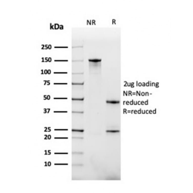 SDS-PAGE - Anti-BAFF-R Antibody [BAFFR/1558] (A248219) - Antibodies.com