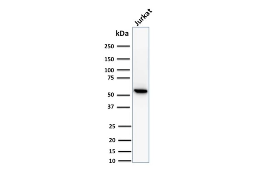 Western Blot - Anti-TOP1MT Antibody [TOP1MT/488] (A248221) - Antibodies.com