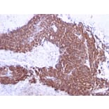 Immunohistochemistry - Anti-TOP1MT Antibody [TOP1MT/613] (A248223) - Antibodies.com