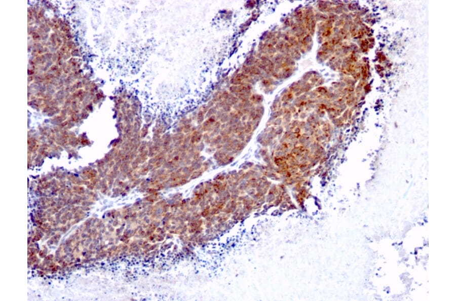 Immunohistochemistry - Anti-TOP1MT Antibody [TOP1MT/613] (A248223) - Antibodies.com