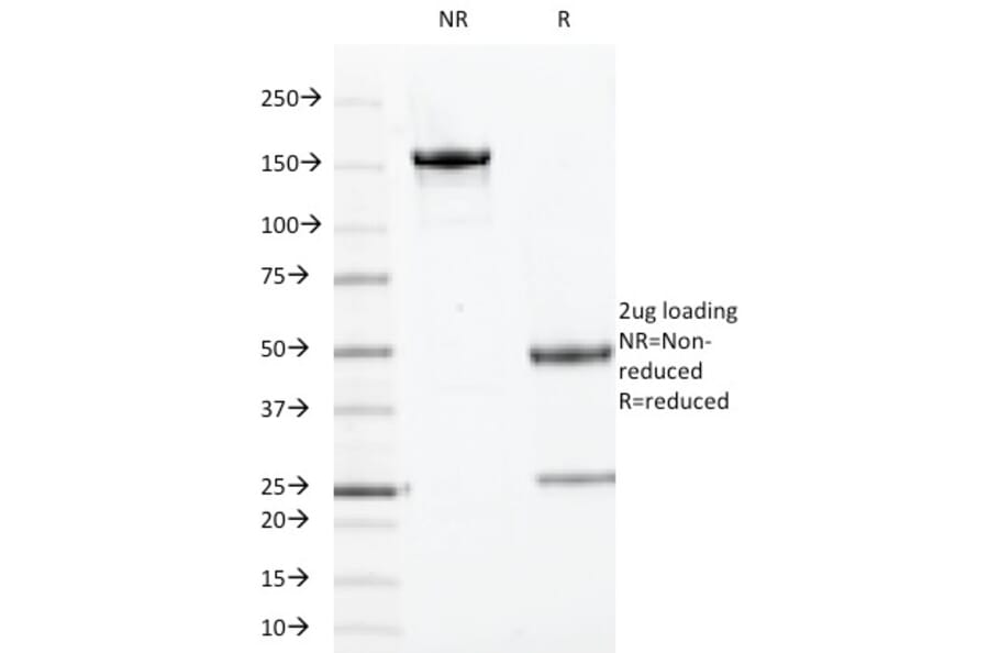 SDS-PAGE - Anti-TOP1MT Antibody [TOP1MT/613] (A248223) - Antibodies.com