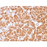 Immunohistochemistry - Anti-Clathrin Light Chain Antibody [CLC/1421] (A248224) - Antibodies.com