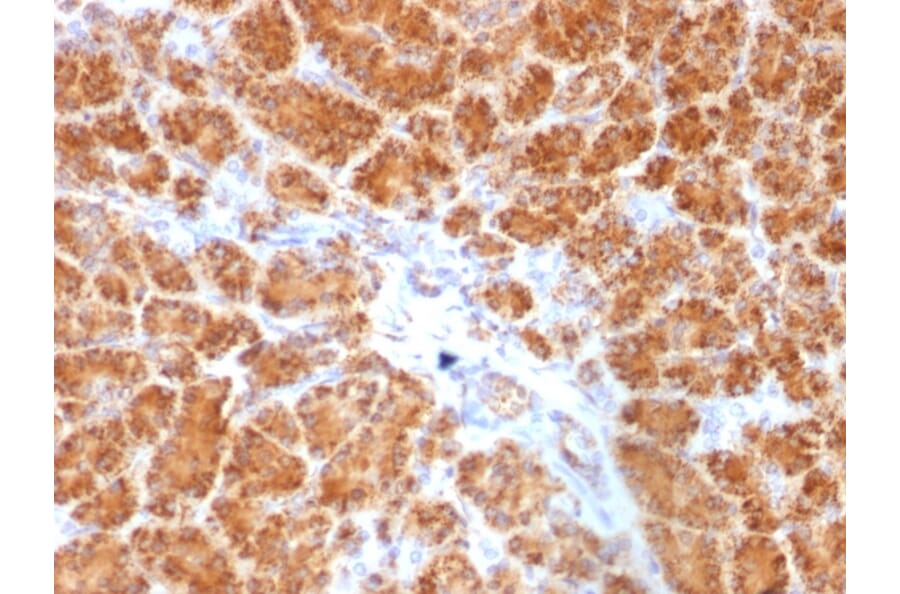 Immunohistochemistry - Anti-Clathrin Light Chain Antibody [SPM174] (A248225) - Antibodies.com