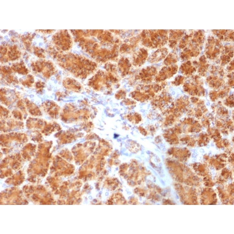 Immunohistochemistry - Anti-Clathrin Light Chain Antibody [SPM174] (A248225) - Antibodies.com