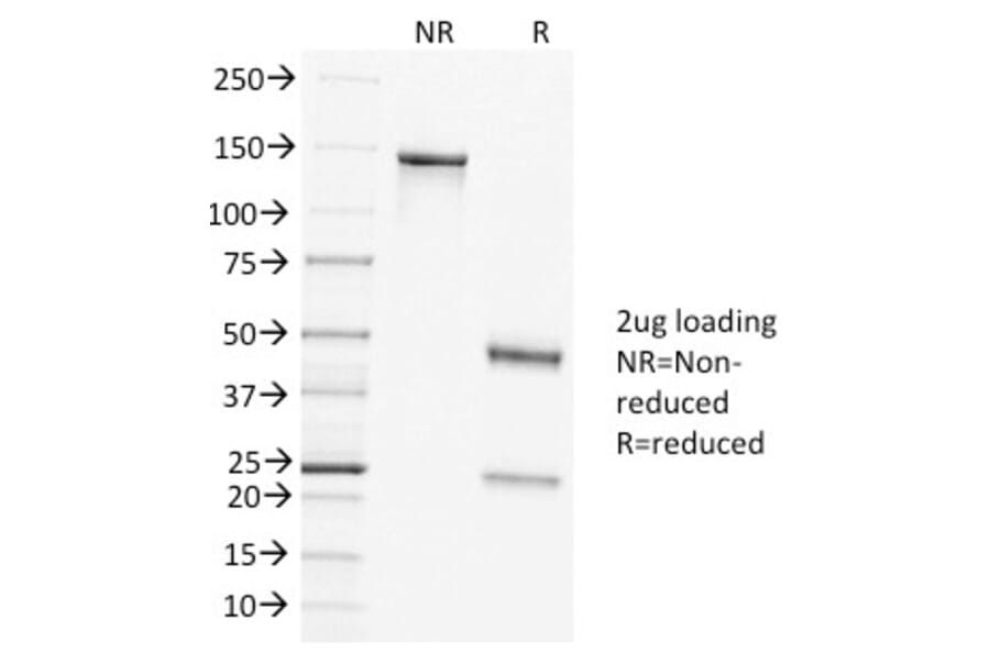 SDS-PAGE - Anti-Clathrin Heavy Chain Antibody [CLTC/1431] (A248226) - Antibodies.com