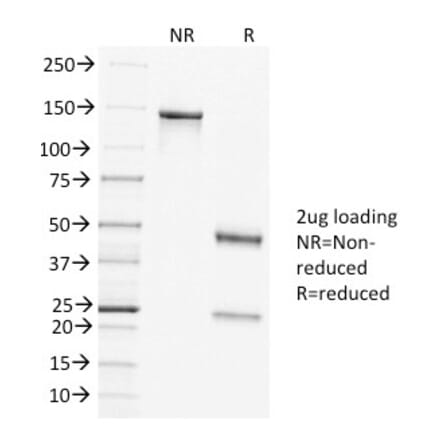 SDS-PAGE - Anti-Clathrin Heavy Chain Antibody [CLTC/1431] (A248226) - Antibodies.com