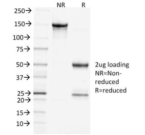 SDS-PAGE - Anti-Clathrin Heavy Chain Antibody [CHC/1432] (A248228) - Antibodies.com