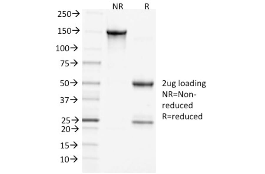 SDS-PAGE - Anti-Clathrin Heavy Chain Antibody [CHC/1432] (A248228) - Antibodies.com