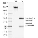 SDS-PAGE - Anti-Clathrin Heavy Chain Antibody [CHC/1432] (A248228) - Antibodies.com