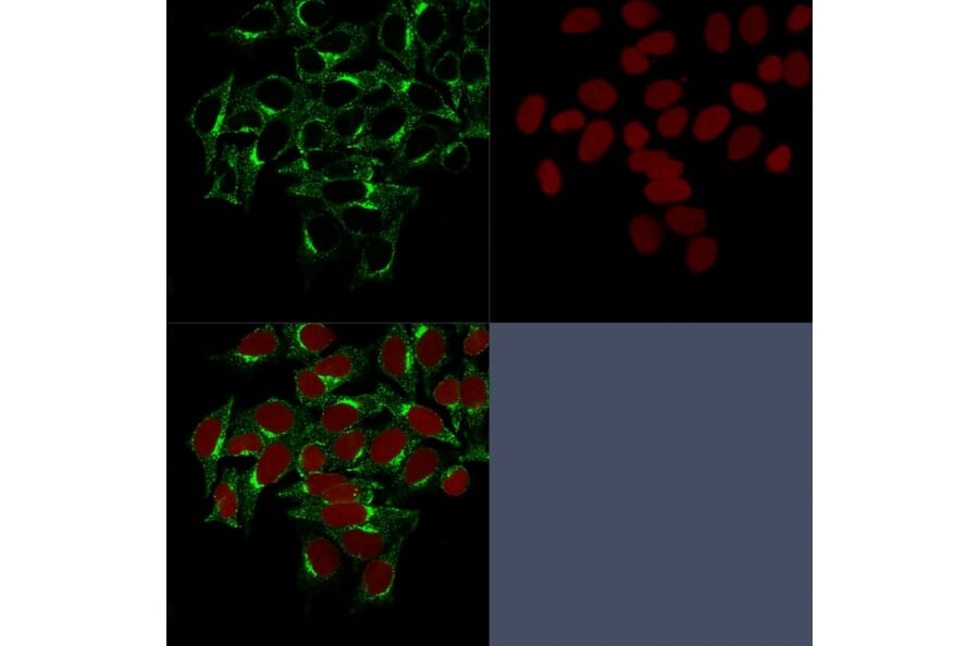 Immunofluorescence - Anti-Clathrin Heavy Chain Antibody [CHC/1432] (A248227) - Antibodies.com