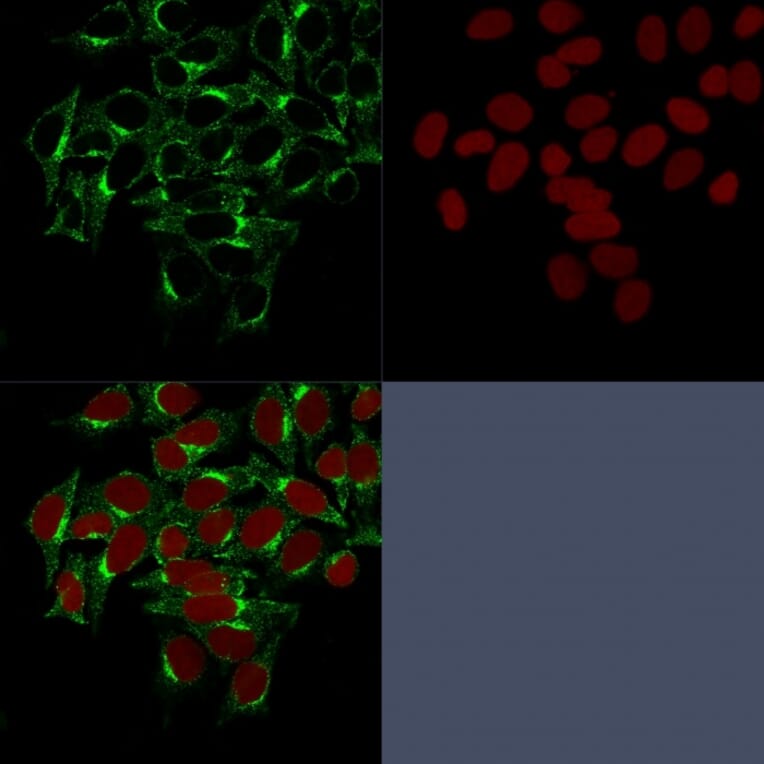 Immunofluorescence - Anti-Clathrin Heavy Chain Antibody [CHC/1432] (A248227) - Antibodies.com