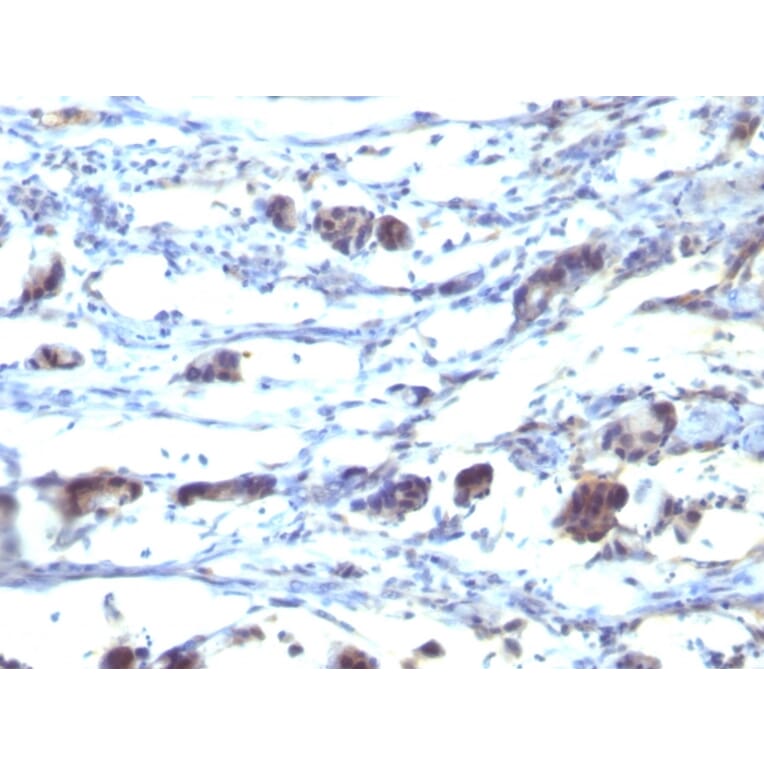 Immunohistochemistry - Anti-CD195 Antibody [12D1] (A248230) - Antibodies.com