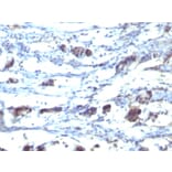 Immunohistochemistry - Anti-CD195 Antibody [12D1] (A248230) - Antibodies.com