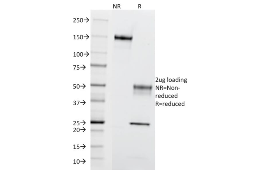 SDS-PAGE - Anti-CD195 Antibody [12D1] (A248230) - Antibodies.com